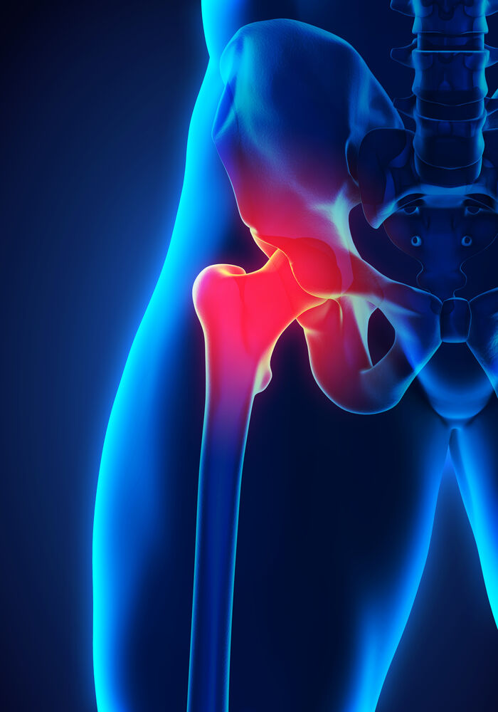 Spring Hill Hip Surgery and Treatment - Hernando Orthopedic